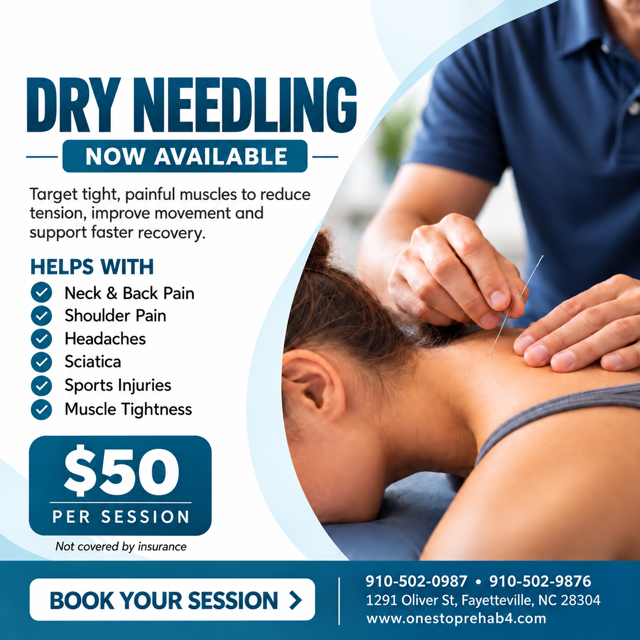 Dry needling now available at One Stop Rehab - $50 per session